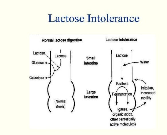 Lactose_Intolerance_Diagram